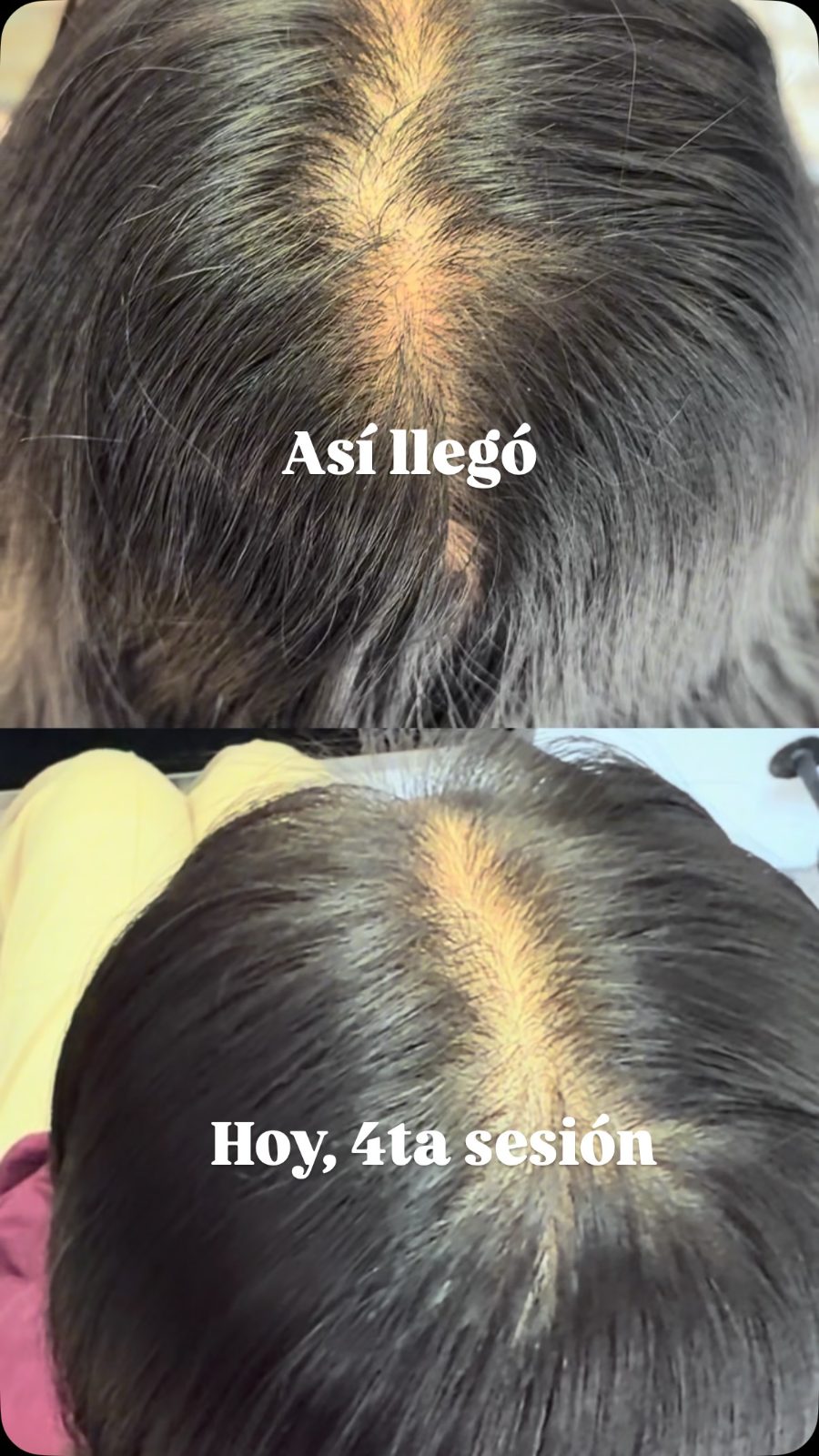 Así llegó y cómo está en la cuarta sesión
