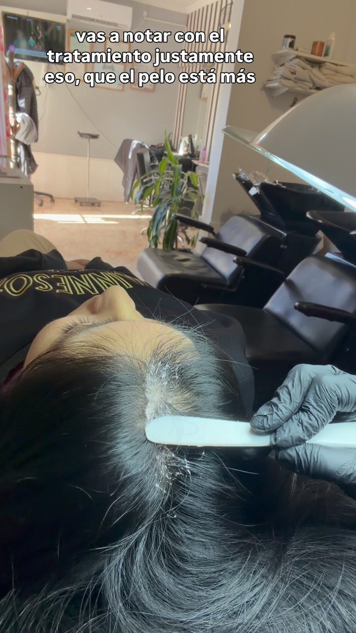Peeling y extracciones en el cuero cabelludo