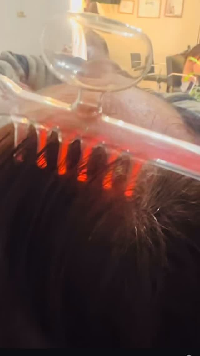 Luz roja aplicada en el cuero cabelludo